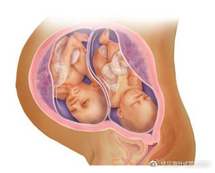 郑州供卵机构联系_先天性子宫小能通过试管婴儿怀双胞胎吗？