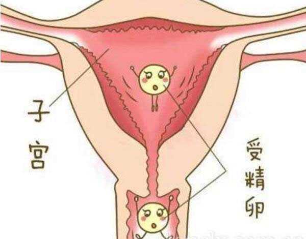 重庆代孕公司哪家做的最好_泰国试管婴儿可以科学避免生化妊娠吗?