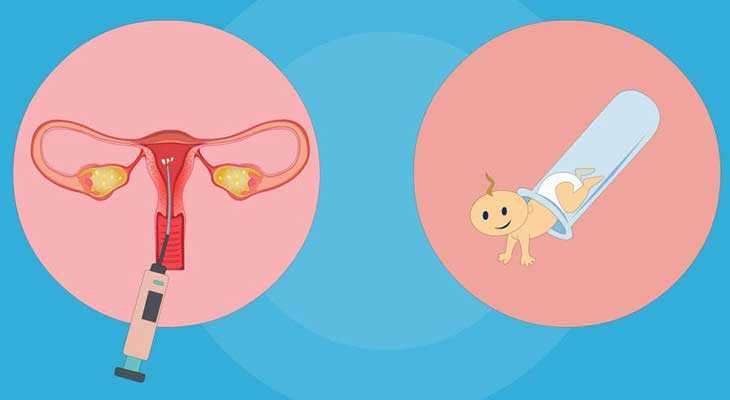 白城代孕方法_七台河姐妹子宫内膜异位症如何减少手术次数，增加试管婴儿成